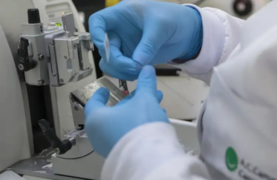 SUS oferece novo tratamento para leucemia mieloide aguda