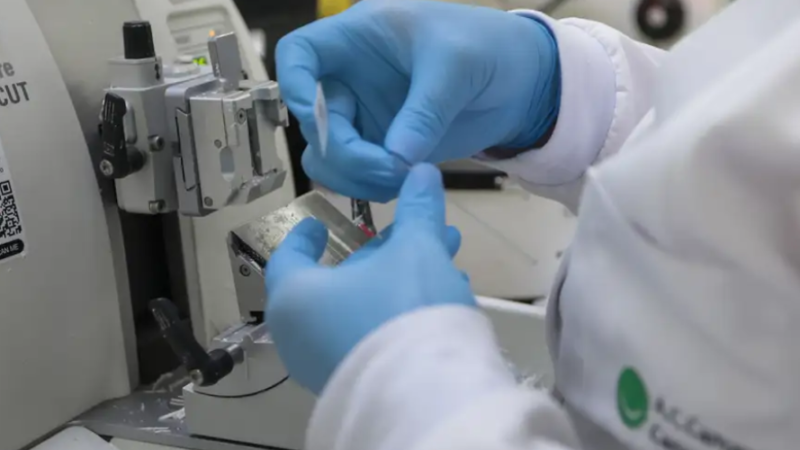 SUS oferece novo tratamento para leucemia mieloide aguda