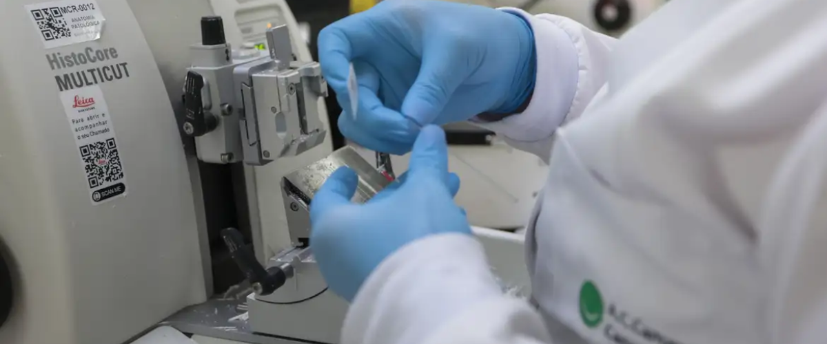 SUS oferece novo tratamento para leucemia mieloide aguda