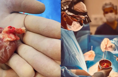 São realizados primeiros transplantes cardíacos pediátricos em Hospital Universitário do Ceará