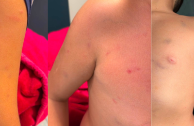 Mãe denuncia agressão física contra filho de 11 anos em escola particular no Eusébio e decide processar instituição
