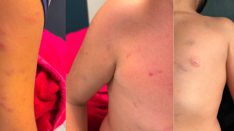 Mãe denuncia agressão física contra filho de 11 anos em escola particular no Eusébio e decide processar instituição