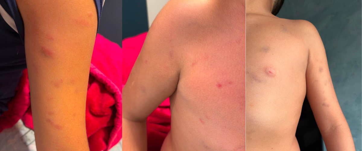 Mãe denuncia agressão física contra filho de 11 anos em escola particular no Eusébio e decide processar instituição